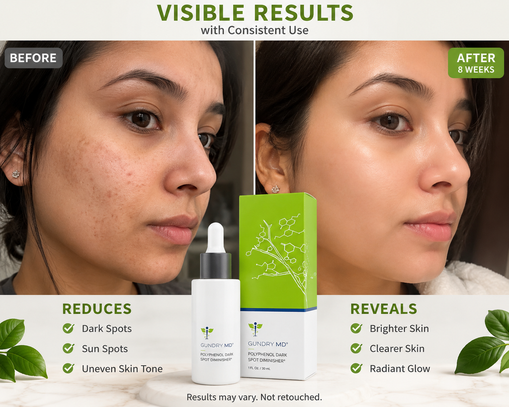 Gundry MD Dark Spot Diminisher Serum 1 oz | Best Buyers Shop